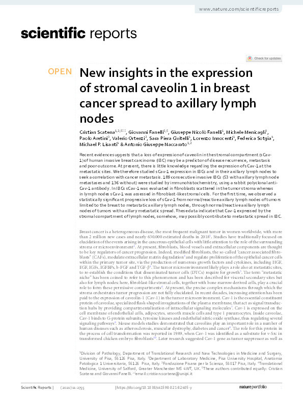 New insights in the expression of stromal caveolin 1 in breast cancer spread to axillary lymph nodes Thumbnail