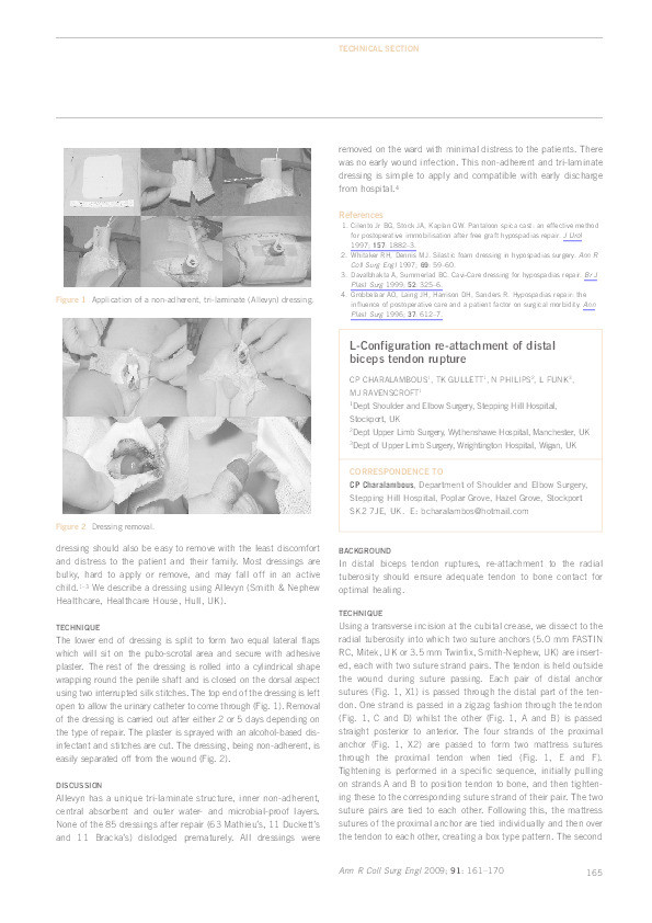 L-configuration re-attachment of distal biceps tendon rupture Thumbnail