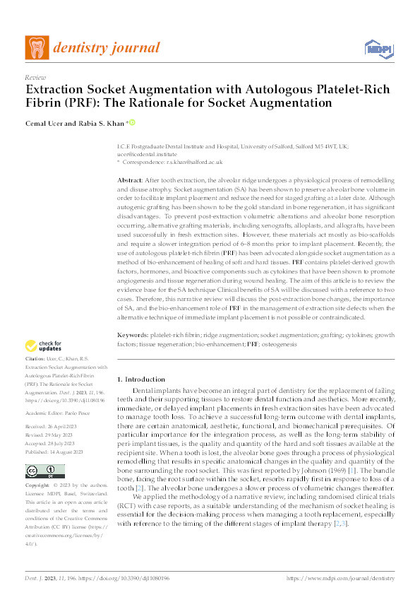 Extraction Socket Augmentation with Autologous Platelet-Rich Fibrin (PRF): The Rationale for Socket Augmentation Thumbnail