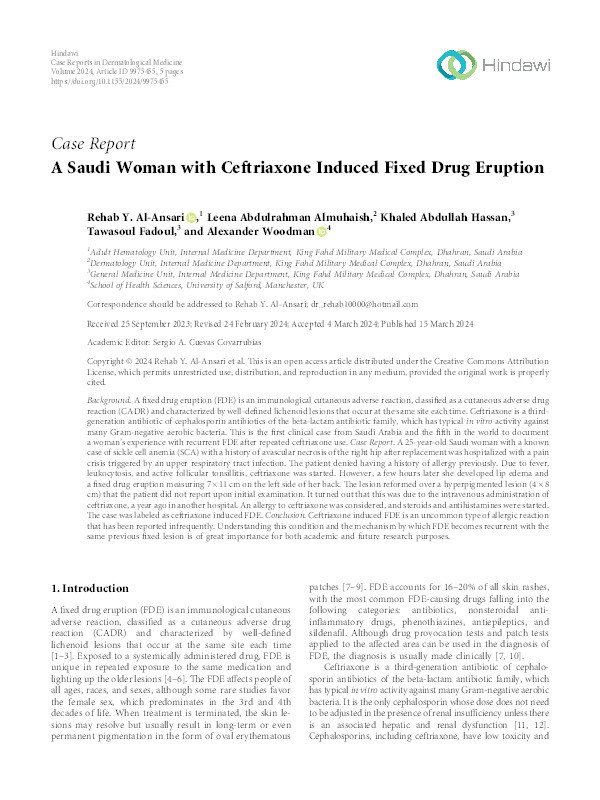 A Saudi Woman with Ceftriaxone Induced Fixed Drug Eruption Thumbnail